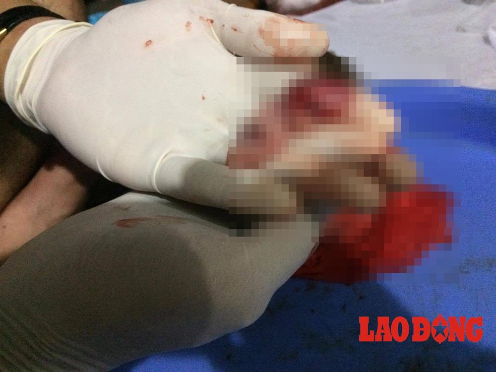 Những thai nhi vô tội được A nhặt về.