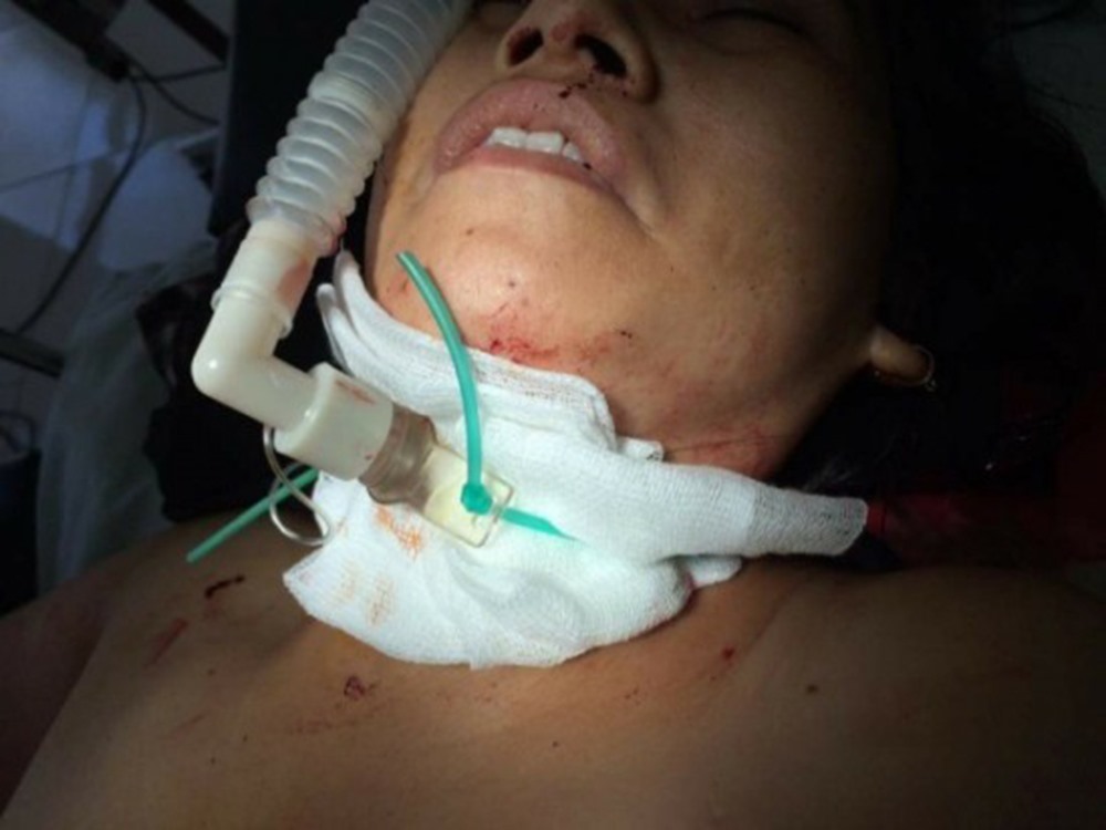 Chị Kim Anh nhập viện trong tình trạng rất nguy kịch. Ảnh: BTN.