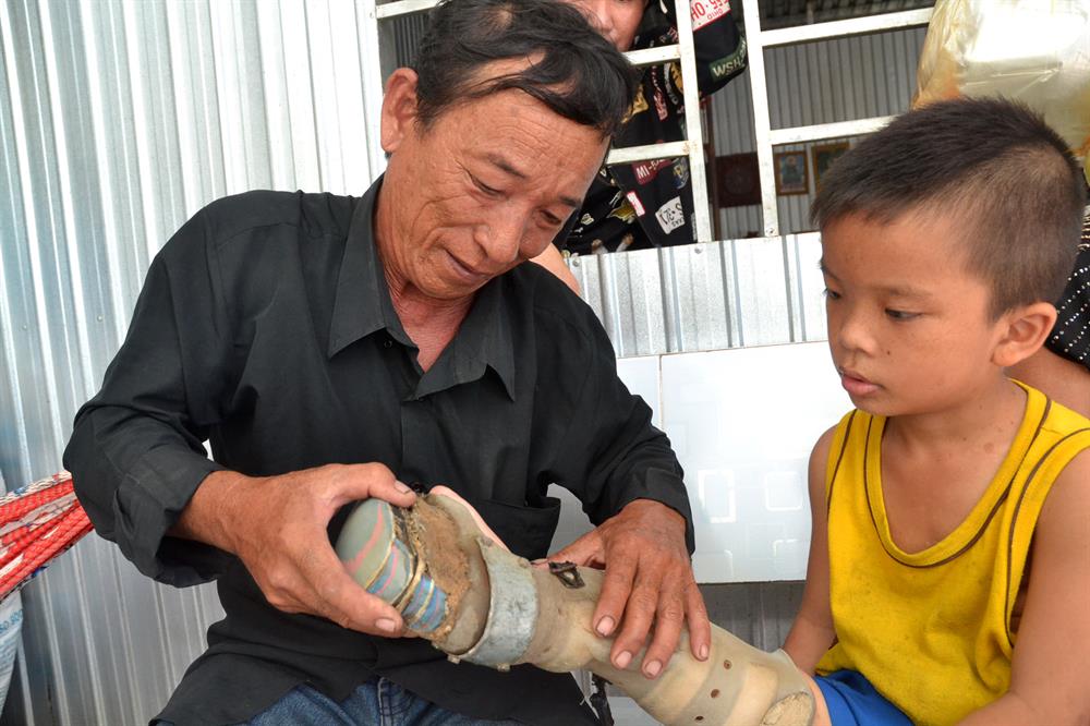 Không có tiền để làm mới nên ông Vũ phải thường xuyên theo dõi và điều chỉnh chân niềng cho Hiền.
