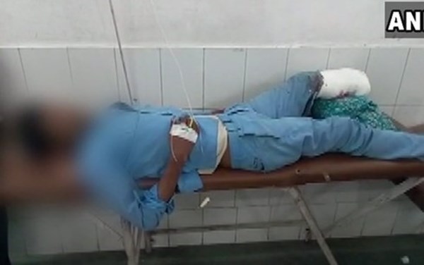 Nóng nhất hôm nay: Bác sĩ lấy chân bị cắt rời làm gối đầu cho bệnh nhân gây sốc