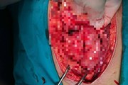 Hà Nội: Nam thanh niên bị đâm thấu bụng, thấu ngực Hà Nội: Nam thanh niên bị đâm thấu bụng, thấu ngực