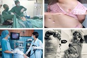 Một vòng bệnh viện: Suýt mất mạng vì bàn chân hoại tử Một vòng bệnh viện: Suýt mất mạng vì bàn chân hoại tử