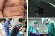 Một vòng bệnh viện: Cắt u nang buồng trứng xoắn cho bệnh nhi 12 tuổi Một vòng bệnh viện: Cắt u nang buồng trứng xoắn cho bệnh nhi 12 tuổi
