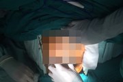 Bé trai 11 tháng tuổi bị mẹ dùng dao đâm vào bụng nguy kịch Bé trai 11 tháng tuổi bị mẹ dùng dao đâm vào bụng nguy kịch