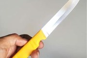 Trượt chân, người phụ nữ bị dao gọt hoa quả đâm xuyên vào trong sọ não Trượt chân, người phụ nữ bị dao gọt hoa quả đâm xuyên vào trong sọ não