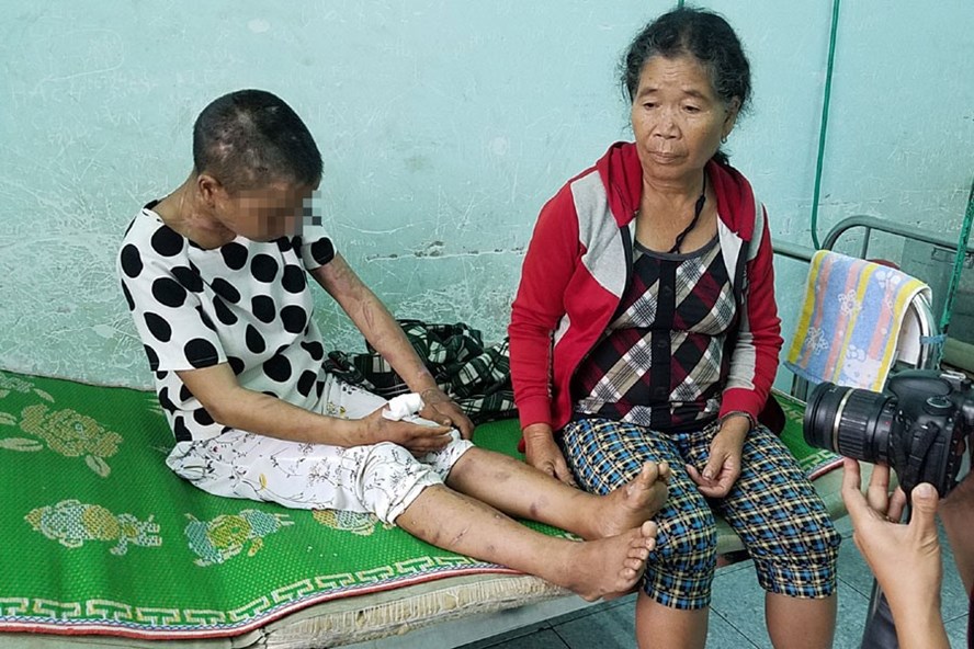 Vụ tra tấn bẻ răng, đốt da, chặt tay người làm thuê tại Gia Lai: Phải khởi tố vụ án 1-1_Opt