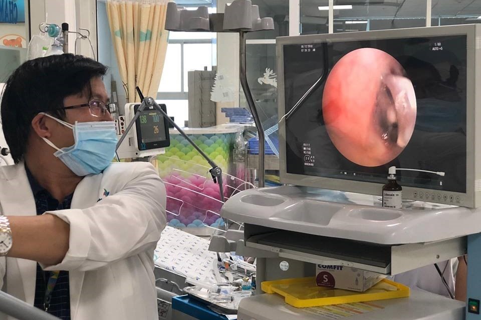 Cách xử trí khi trẻ không may hóc dị vật dịp Tết Cách xử trí khi trẻ không may hóc dị vật dịp Tết