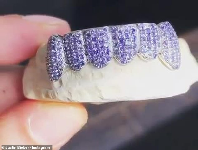 Bộ răng nạm kim cương Israeli tím của Justin trị giá 580 triệu đồng. Ảnh: Dailymail.