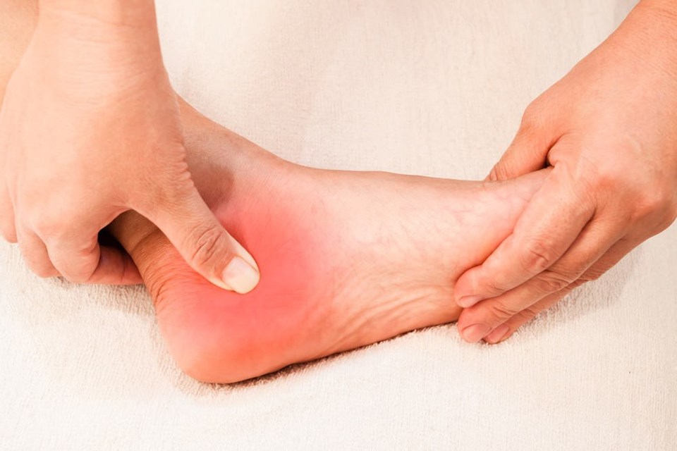 Vùng gót chân có thể sưng, nóng, đỏ, ấn vào đau. (Ảnh: ST) Vùng gót chân có thể sưng, nóng, đỏ, ấn vào đau. (Ảnh: ST)