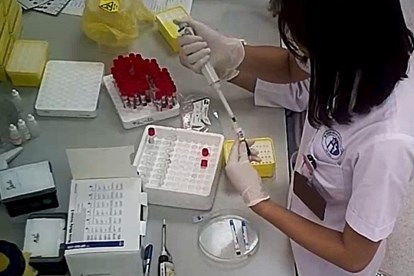 Kết quả hình ảnh cho cắt đôi que thủ hiv