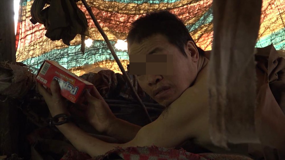 Người tâm thần bị xích tay.