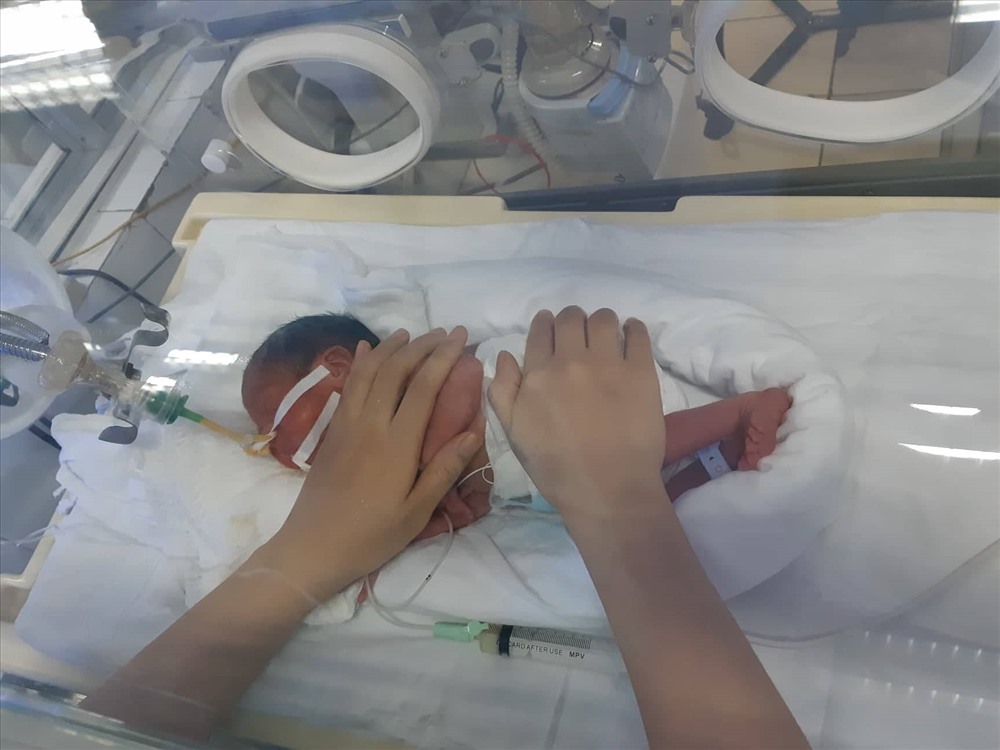 Bé Bình An được tiên lượng tốt, đang dần ổn định. Ảnh: Thùy Linh