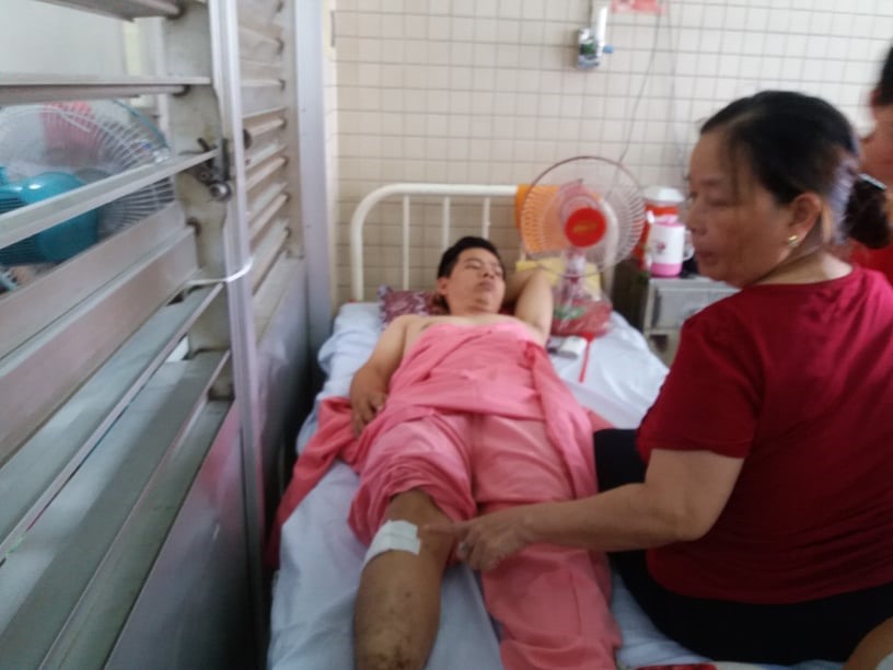 Vị trị bệnh nhân bị khoan xuyên đinh chân nhầm