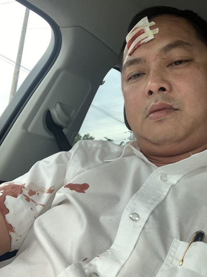 Lương “tố” người trong nhóm bạn của Lương cũng bị nhóm của Hiền đánh bị thương, khâu 14 mũi_Ảnh: CTV