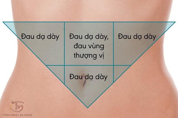 Những vị trí đau dạ dày điển hình ở các bên bệnh nhân cần chú ý