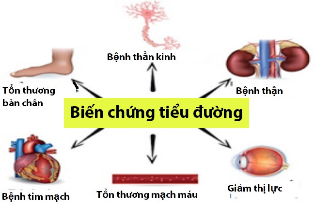 Nhiều người vẫn chủ quan trước những biến chứng từ đái tháo đường