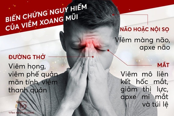 Một số biến chứng nguy hiểm bệnh nhân có thể gặp phải