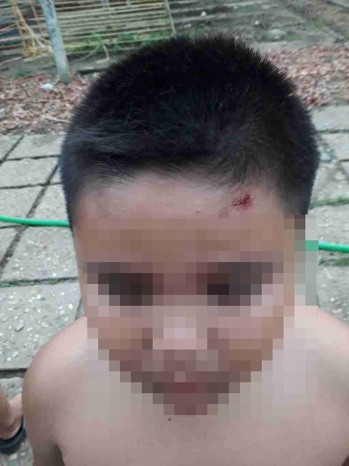 Con trai anh Tý bị thương do nhóm giang hồ gây ra. Ảnh: NVCC