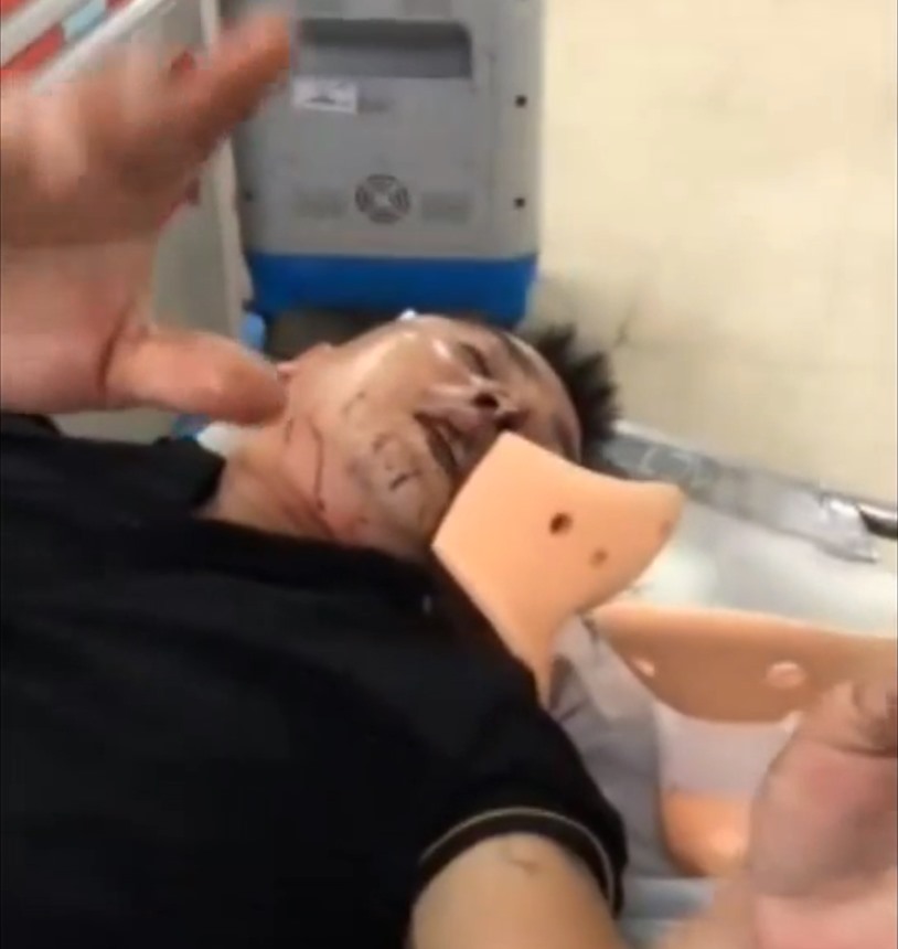 Hiện anh Phong vẫn đang điều trị vết thương tại Bệnh viện. Ảnh NVCC