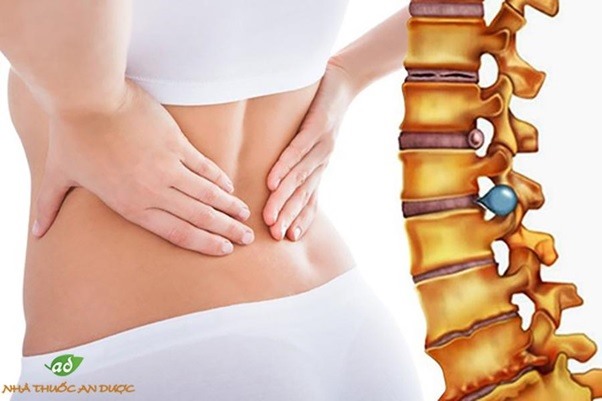 Thoát vị đĩa đệm - Căn bệnh thời đại, nguy hại khôn lường