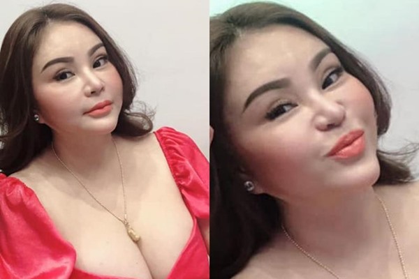 Bức ảnh khiến dấy lên tin đồn nghiện dao kéo của diễn viên hài Lê Giang. Ảnh: ST.