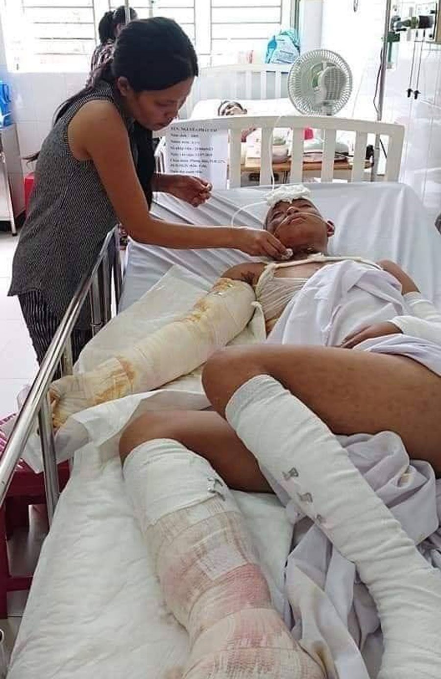 Em Tài hiện đang điều trị tại Bệnh viện Nhi đồng 1, TPHCM trong khi gia đình khánh kiệt. Ảnh: CTV