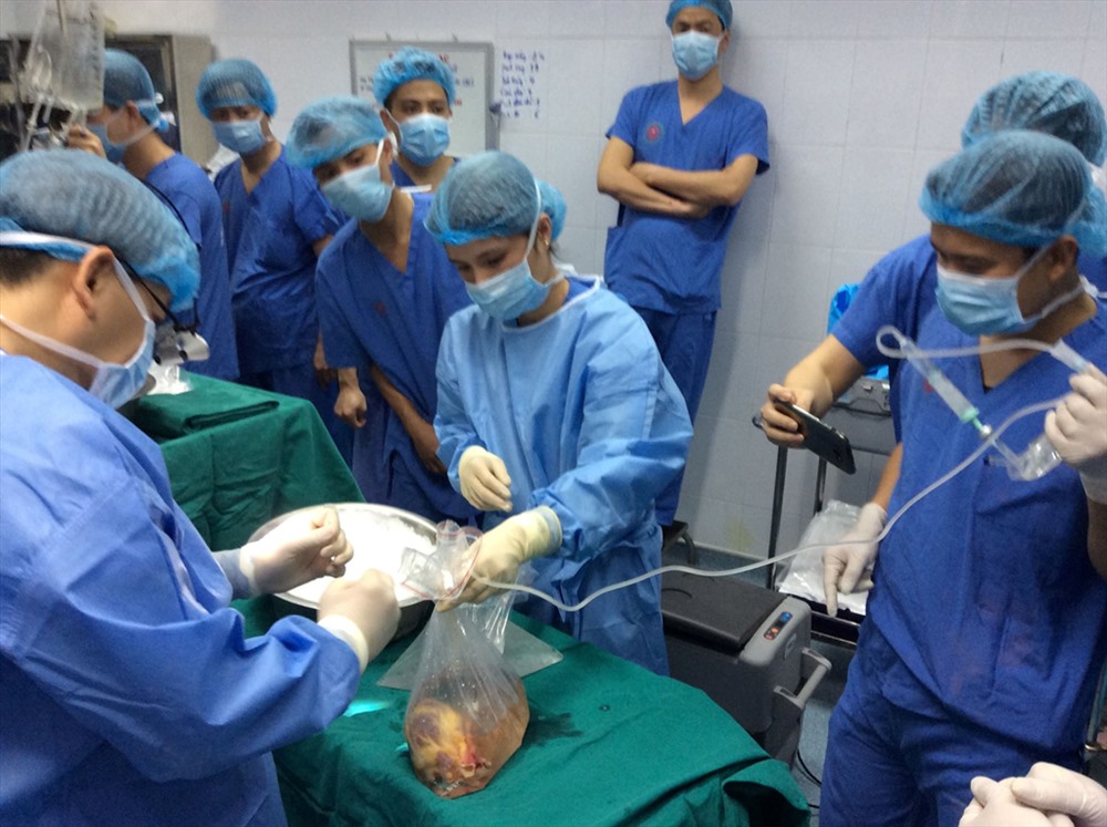 Một ca ghép tim tại Bệnh viện Trung ương Huế. Ảnh: Bệnh viện cung cấp