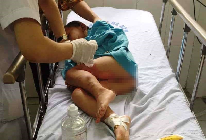 Cháu bé bị bỏng do cô giáo dùng còn dạy kĩ năng phòng cháy đang được các bác sĩ cấp cứu. Ảnh: CTV