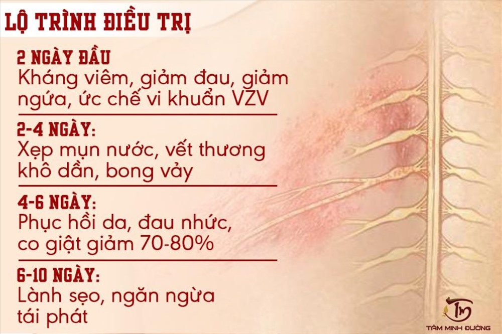 Lộ trình điều trị an toàn và hiệu quả tận gốc của bài thuốc