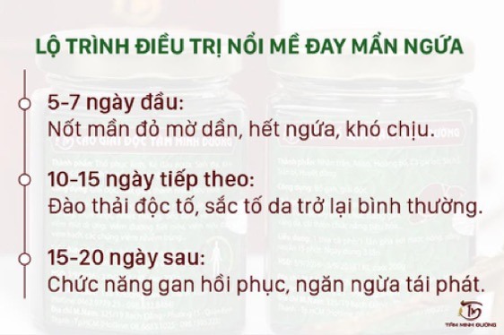 Lộ trình điều trị mề đay mẩn ngứa an toàn, tận gốc