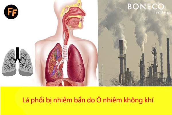 Ảnh: bachmai.gov.vn.