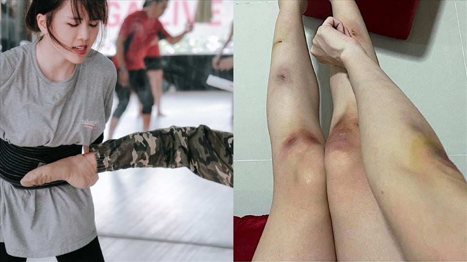 Thiều Bảo Trâm bầm dập vì luyện tập cho MV mới. Ảnh: NSCC Thiều Bảo Trâm bầm dập vì luyện tập cho MV mới. Ảnh: NSCC