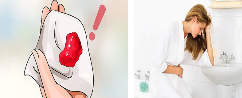 Chảy máu âm đạo thường xuyên là dấu hiệu mang thai ngoài tử cung thường gặp phải. Đồ họa: Hồng Nhật