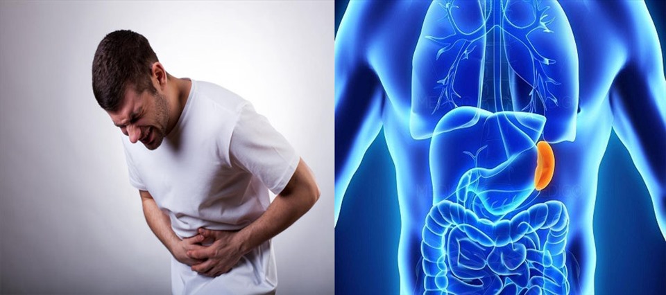 Ung thư lá lách nếu không được phát hiện và điều trị kịp thời sẽ gây biến chứng nguy hiểm cho người bệnh. Đồ họa: Kim Nhung
