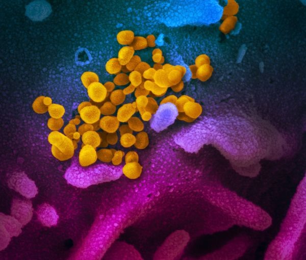Ảnh virus sinh trưởng trong môi trường nuôi cấy. Nguồn: NIAID-RML.