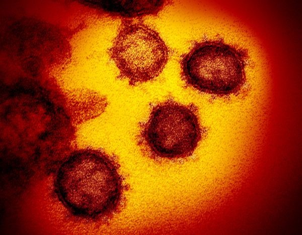 Ảnh virus qua kính hiển vi điện tử truyền qua. Nguồn: NIAID-RML.