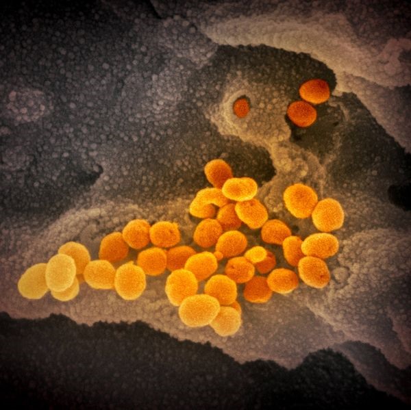 Ảnh virus sinh trưởng trong môi trường nuôi cấy. Nguồn: NIAID-RML.