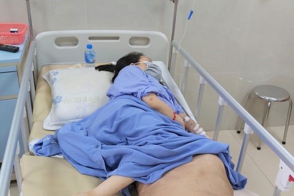 Bệnh nhân H đã được truyền 8 đơn vị máu nhóm A và dự kiến tiếp tục cần máu trong ca phẫu thuật sắp tới