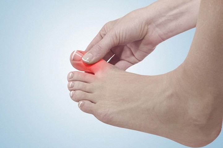 Ngón chân sẽ bị sưng, chai vì bị chen nhau trong không gian chật hẹp của giày