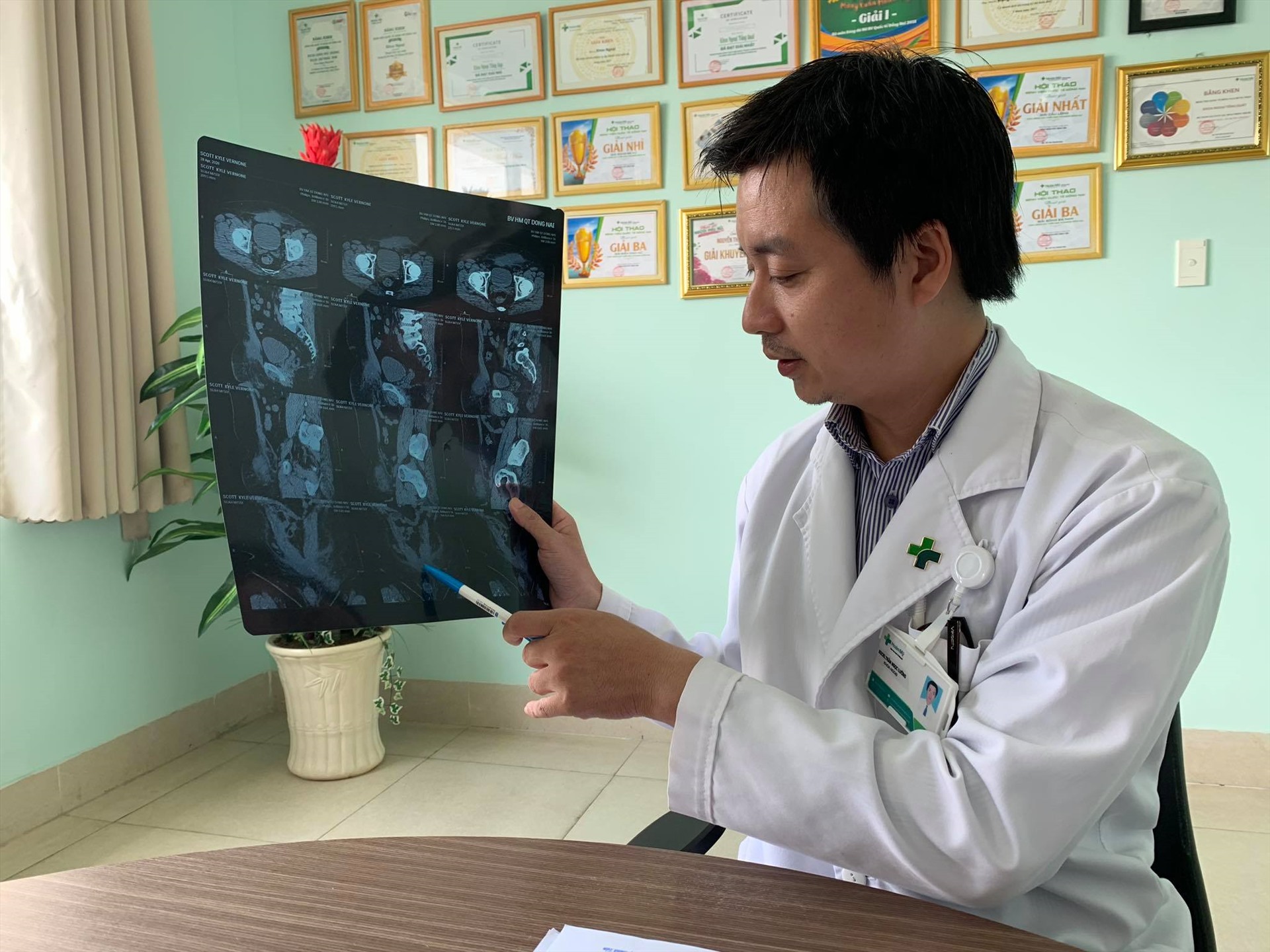 Bác sĩ Trần Ngọc Lưỡng, Khoa Ngoại tổng quát Bệnh viện Quốc tế Hoàn Mỹ Đồng Nai cho biết, đây là trường hợp rất hy hữu. Ảnh: Hoài Thương