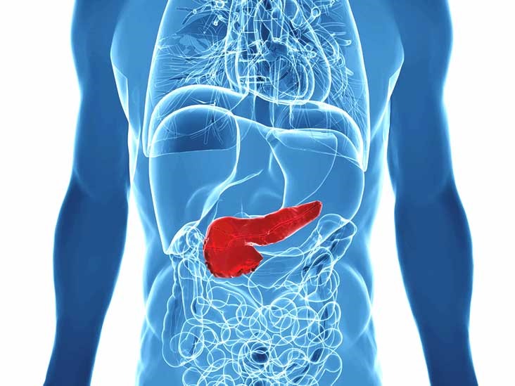 Hình ảnh mô phỏng căn bệnh ung thư tụy. Ảnh: Healthline