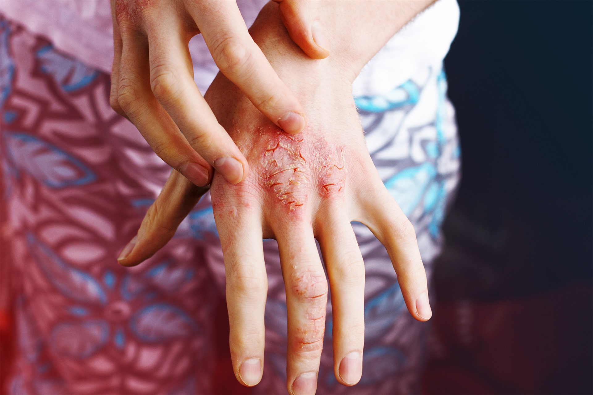 Ảnh Health