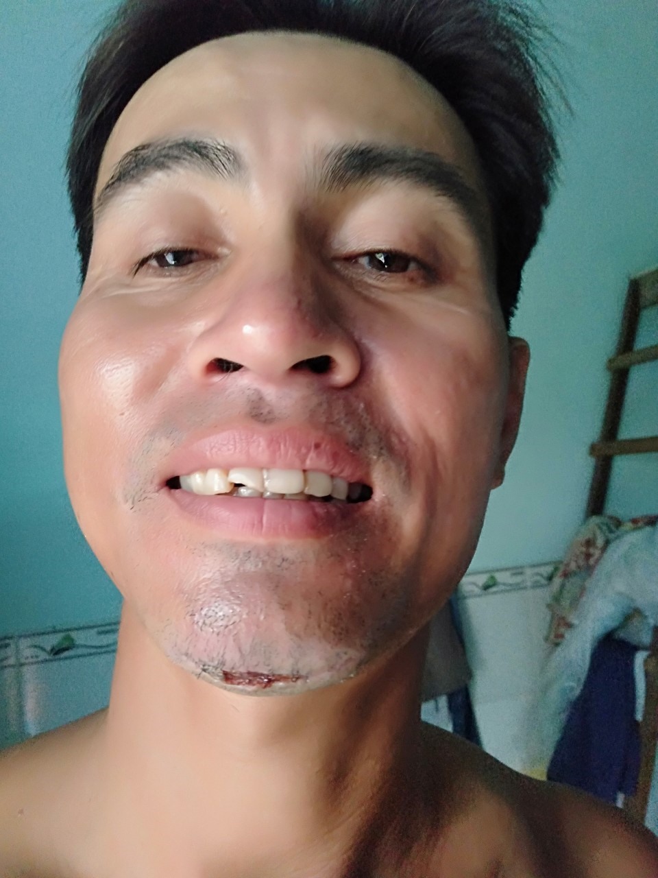 Anh Thanh dù thương tật nhưng vẫn đi làm phụ hồ nuôi vợ con. Ảnh: K.Q