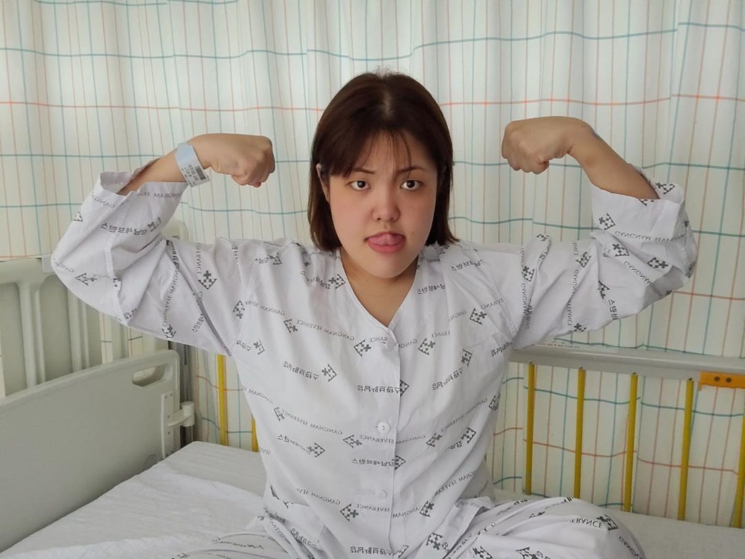 Hình ảnh “thánh ăn” Yang Soobin sau ca phẩu thuật cắt nửa tuyến giáp Ảnh: Instagram NV