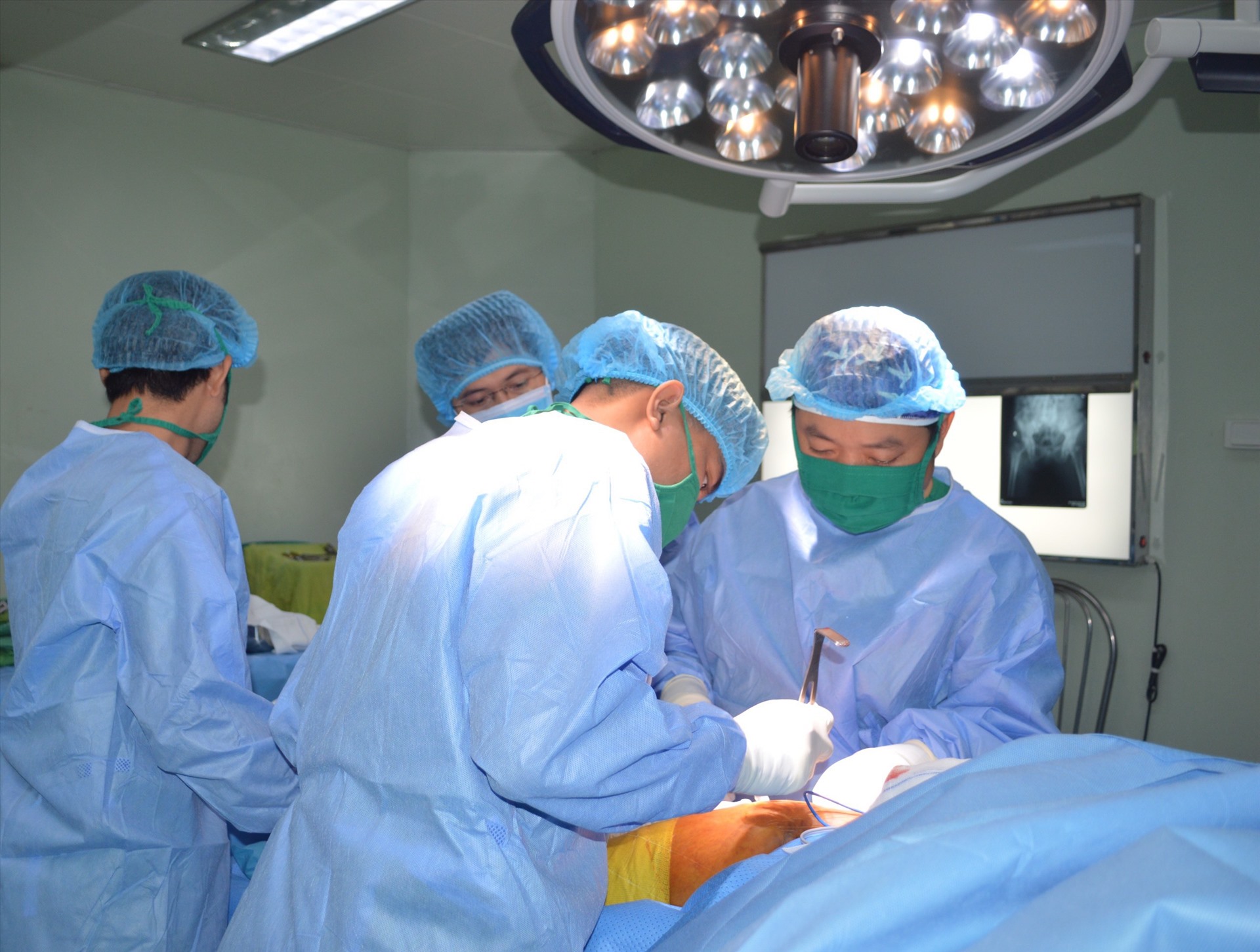 Các bác sĩ tiến hành phẩu thuật cho bệnh nhân. Ảnh: BV cung cấp