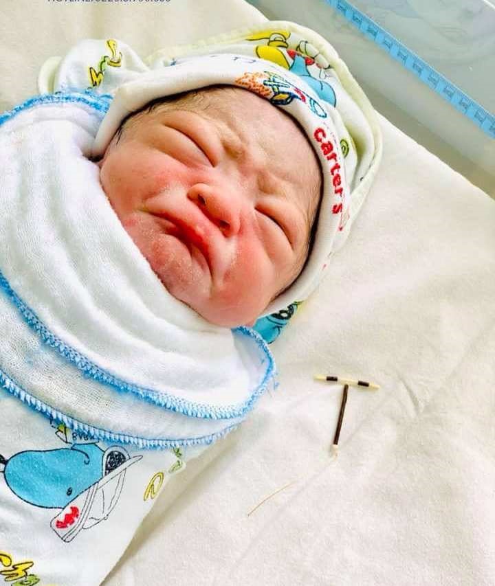 Bé trai nặng 3,3kg, chào đời sáng 30.6 cùng với vòng tránh thai trong nhau thai. Ảnh BVĐKQT Hải Phòng