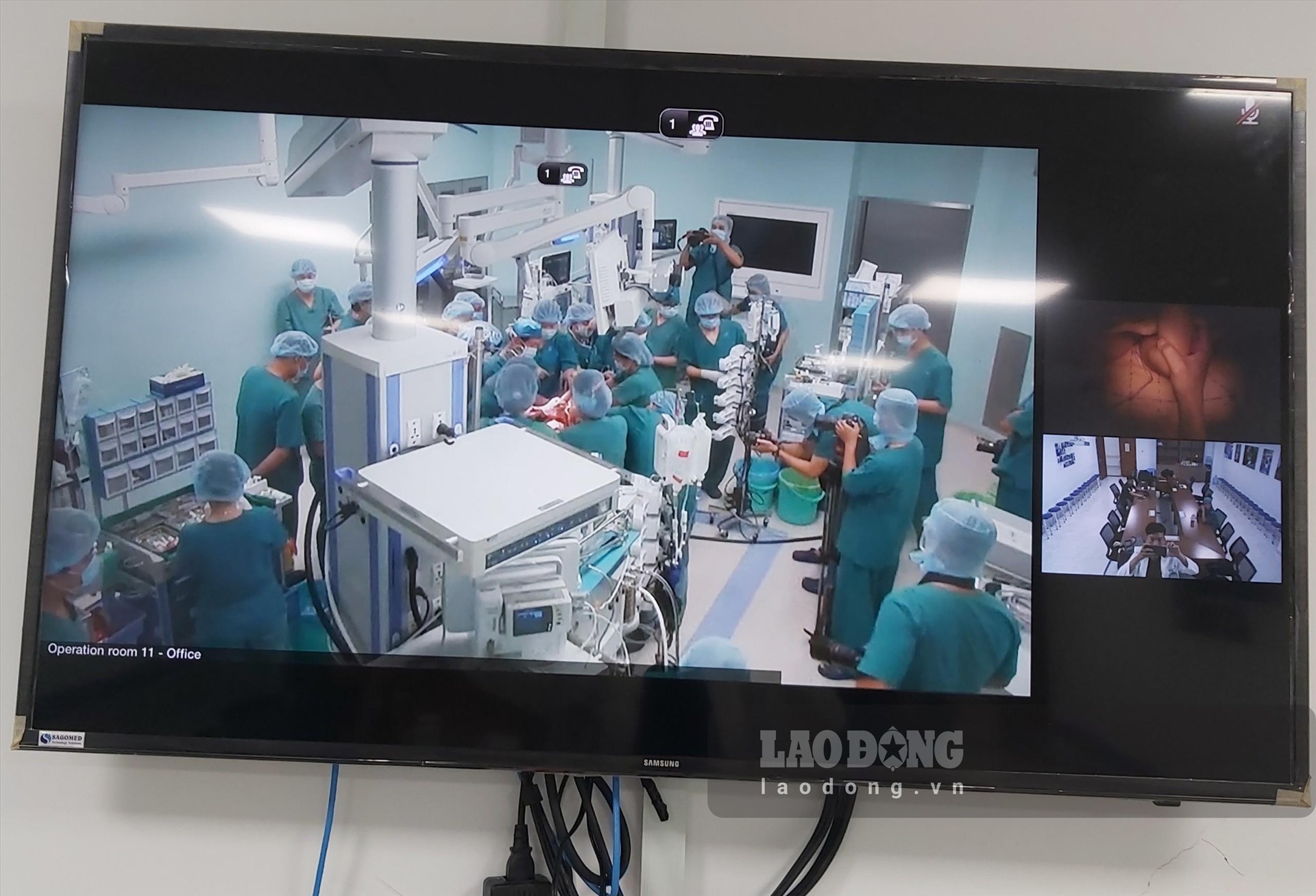 Diễn biến trong phòng mổ được trực tiếp qua màn hình.