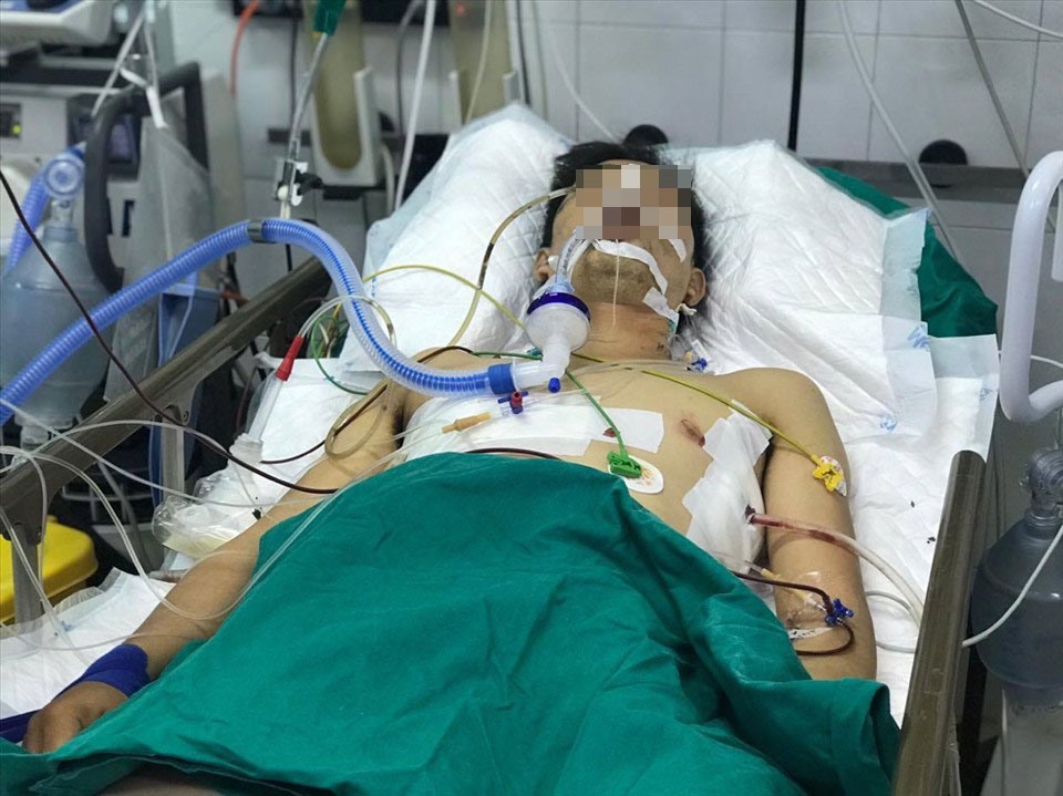 Nạn nhân Q đã qua cơn nguy kịch. Ảnh do bệnh viện cung cấp.