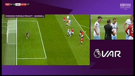 Pogba sau tình huống này đã giả vờ bị đau đầu do trúng bóng. Ảnh: BT Sport.