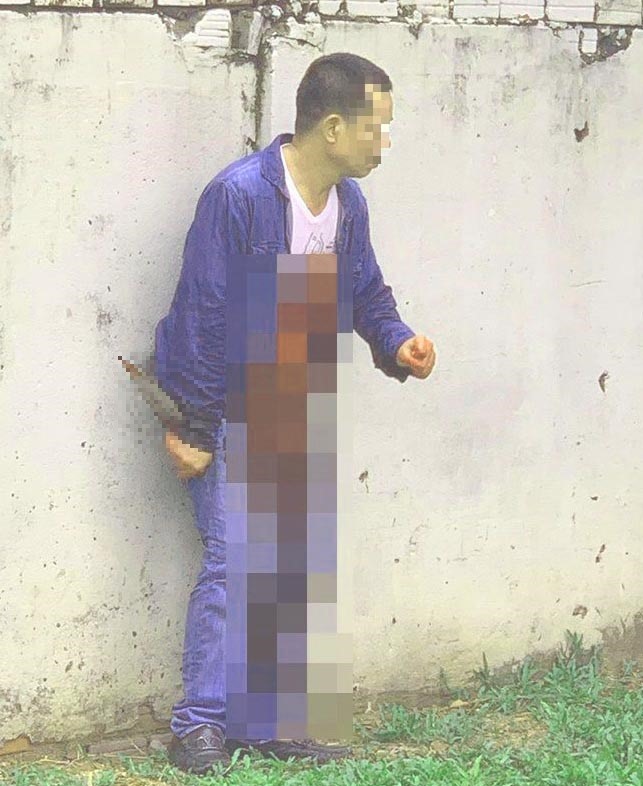 Người đàn ông có biểu hiện bất thường, dùng dao tự đâm vào bụng dẫn tới bị thương. Ảnh: Hiệp Hoàng